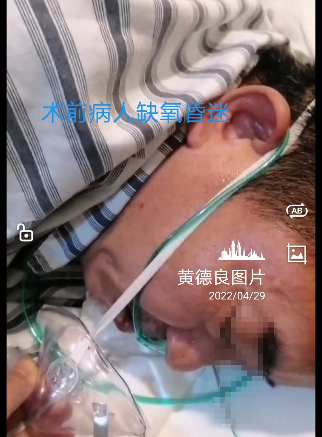 Patient in coma before surgery Patient in coma before surgery